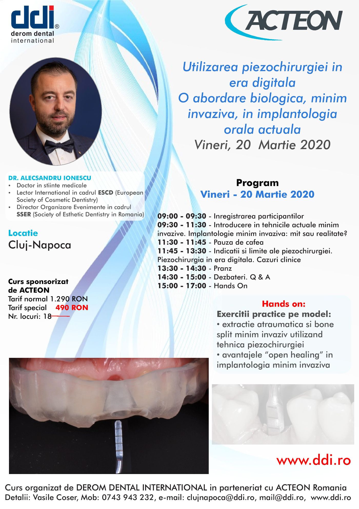 Curs - Utilizarea Piezochirurgiei In Era Digitala, O Abordare Biologica, Minim Invaziva, In Implatologia Orala Actuala